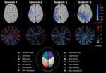 Functional disconnection of associative cortical areas predicts performance during BCI training