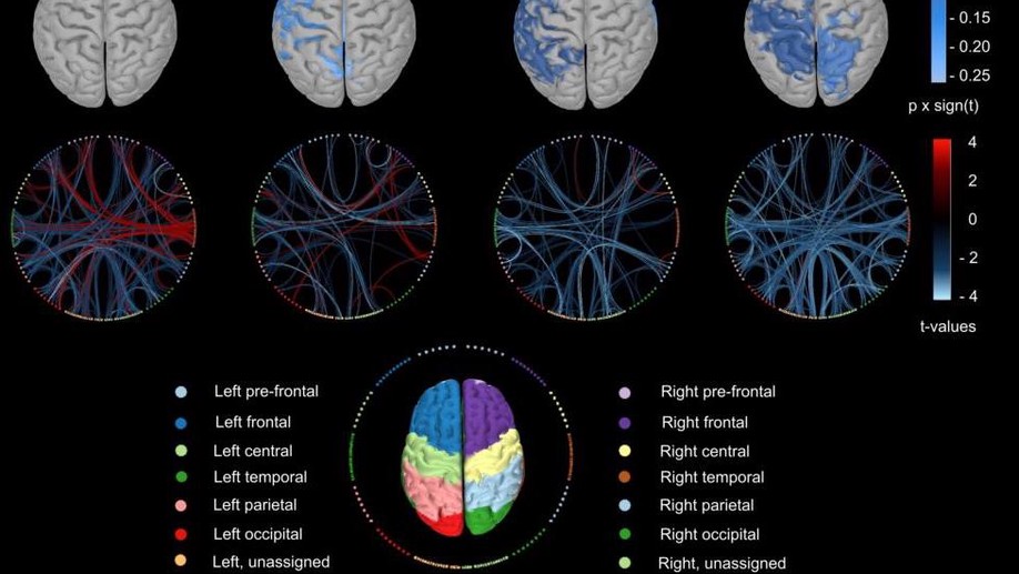 Functional disconnection of associative cortical areas predicts performance during BCI training
