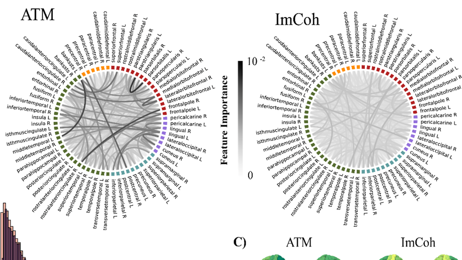 Neuronal avalanches in temporal lobe epilepsy as a noninvasive diagnostic tool investigating large scale brain dynamics