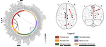 Magnetoencephalography-based interpretable automated differential diagnosis in neurodegenerative diseases