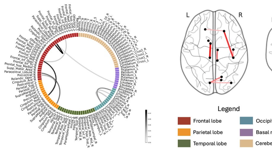 Magnetoencephalography-based interpretable automated differential diagnosis in neurodegenerative diseases