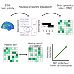 Dynamic reconfiguration of aperiodic brain activity supports cognitive functioning in epilepsy - a neural-fingerprint identification