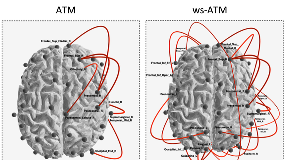 Weighted-stochastic Avalanche Transition Matrix (ws-ATM): a tool to investigate brain dynamic and its neuropathological alterations